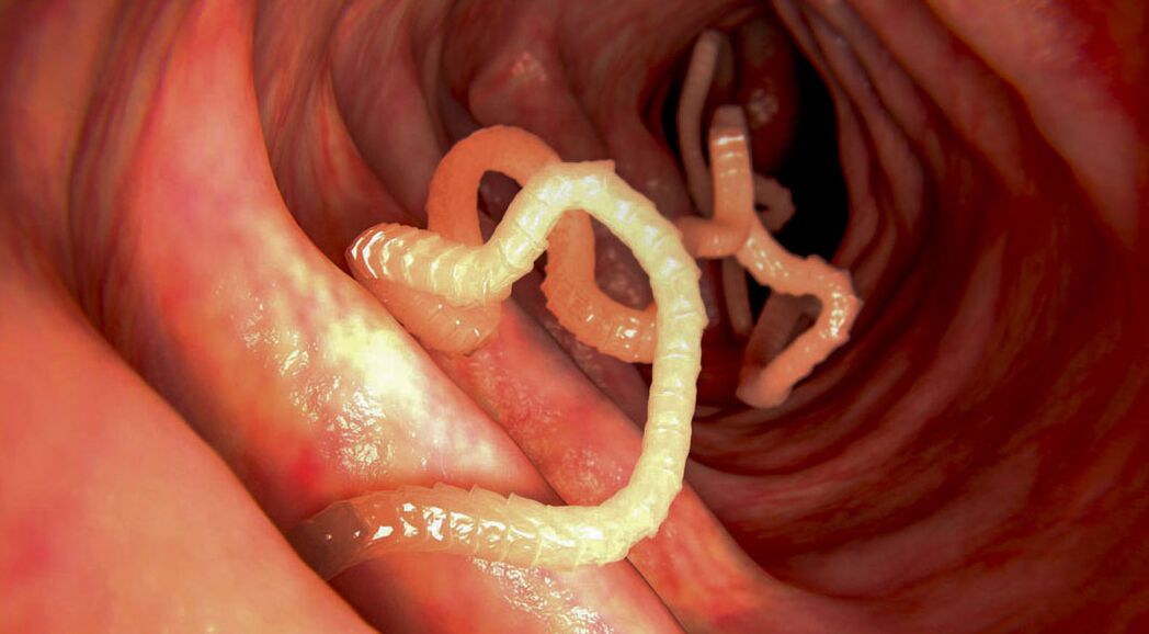 diagnóstico de parasitos nos intestinos