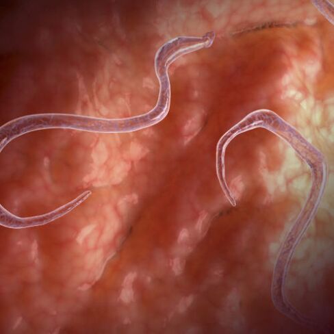 Parásitos nos intestinos