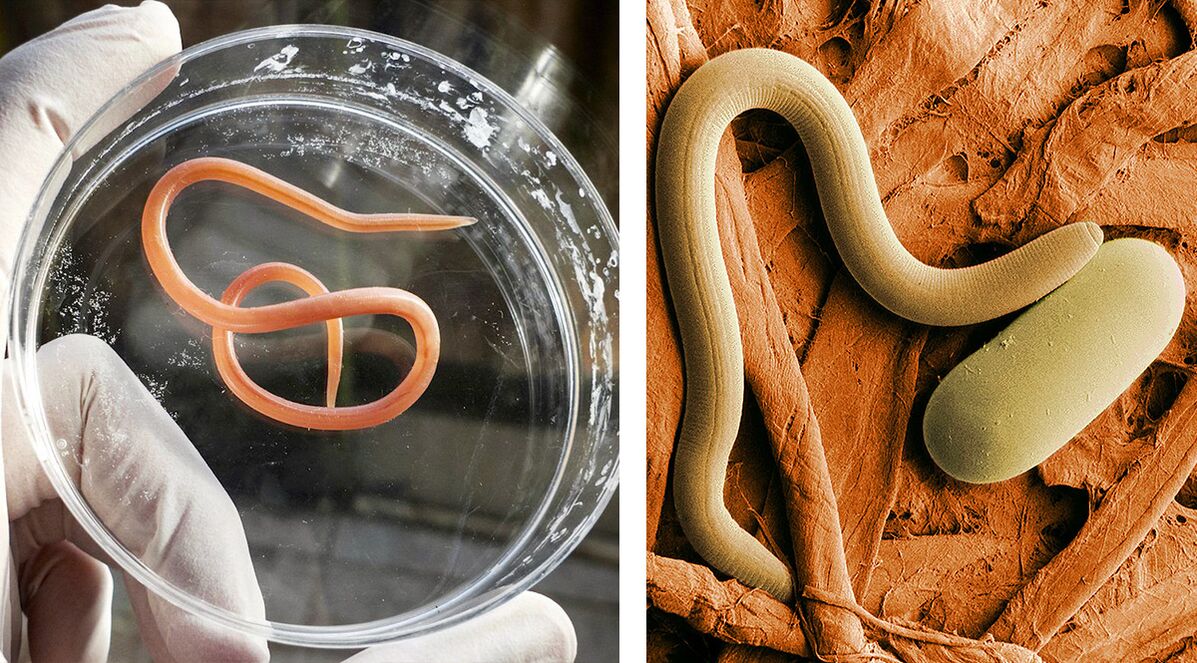 parasitos no corpo humano