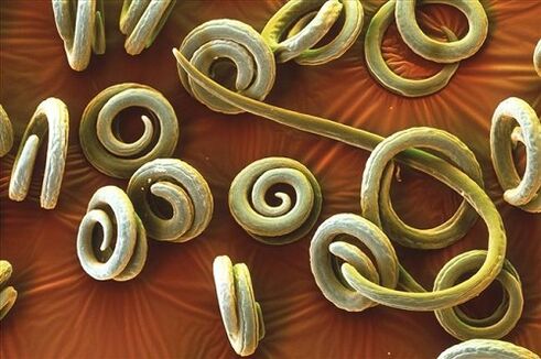 parasitos humanos priquinella